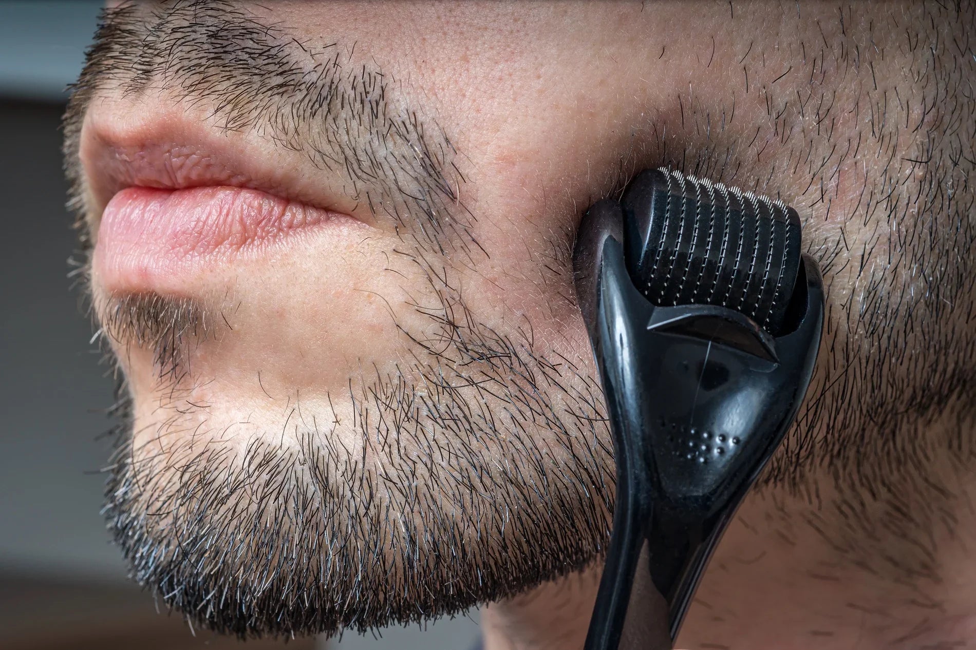 How to Use the Reeviveh Microneedling Roller for Optimal Hair Growth